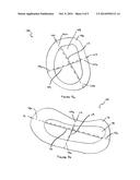 BONE MATRIX COMPOSITIONS AND METHODS diagram and image