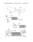 MICROFLUIDIC METHOD AND SYSTEM FOR ISOLATING PARTICLES FROM BIOLOGICAL     FLUID diagram and image