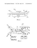 MICROFLUIDIC METHOD AND SYSTEM FOR ISOLATING PARTICLES FROM BIOLOGICAL     FLUID diagram and image