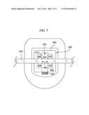 Orthodontic Connector Assembly and a Method for Treating Teeth diagram and image