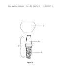 Method of dental implant restoration diagram and image