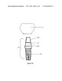 Method of dental implant restoration diagram and image