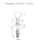 Method of dental implant restoration diagram and image