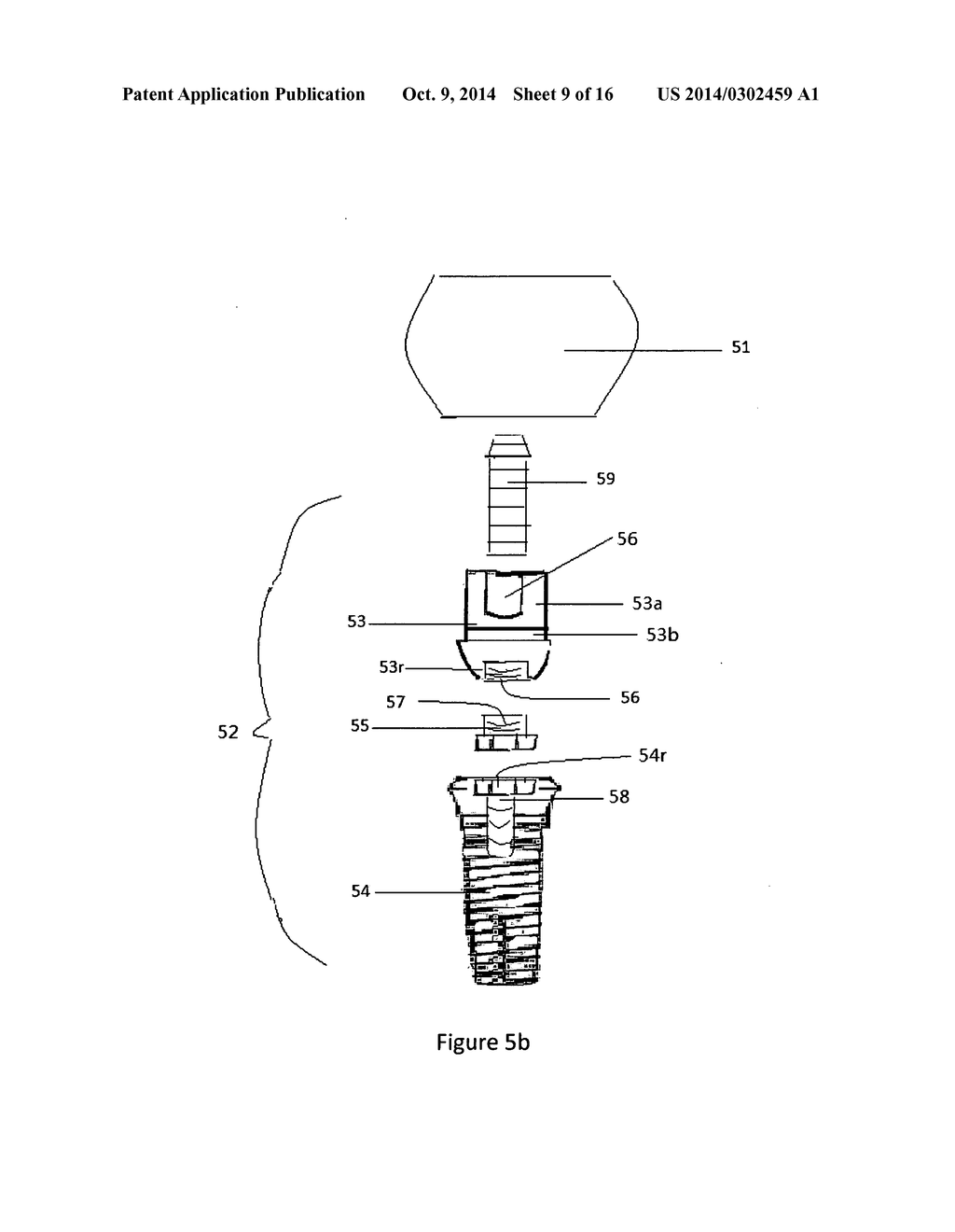 Method of dental implant restoration - diagram, schematic, and image 10