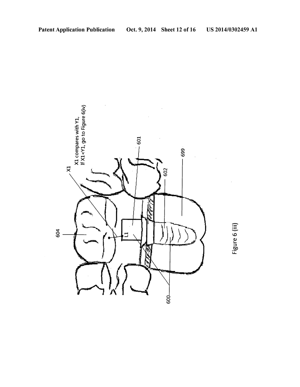 Method of dental implant restoration - diagram, schematic, and image 13