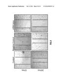 BIOMARKERS FOR BREAST CANCER PATIENTS diagram and image