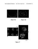 PATTERNING METHOD diagram and image