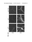 METHOD FOR TREATING NEURODEGENERATION USING A p38MAPK INHIBITOR diagram and image