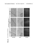 METHOD FOR TREATING NEURODEGENERATION USING A p38MAPK INHIBITOR diagram and image