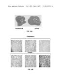 Compositions and Methods for the Treatment of Metabolic Disorders diagram and image