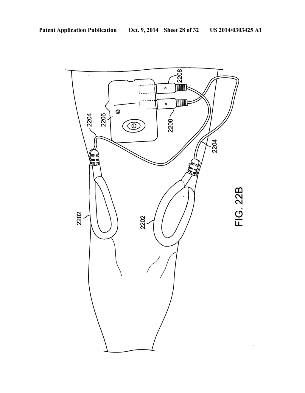 METHOD AND APPARATUS FOR ELECTROMAGNETIC TREATMENT OF COGNITION AND     NEUROLOGICAL INJURY - diagram, schematic, and image 29