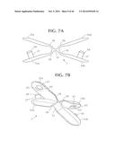 SELF-ANCHORING SLING AND INTRODUCER SYSTEM diagram and image