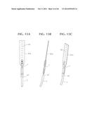 SELF-ANCHORING SLING AND INTRODUCER SYSTEM diagram and image