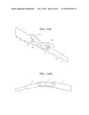 SELF-ANCHORING SLING AND INTRODUCER SYSTEM diagram and image