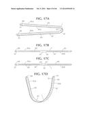SELF-ANCHORING SLING AND INTRODUCER SYSTEM diagram and image