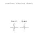 SELF-ANCHORING SLING AND INTRODUCER SYSTEM diagram and image