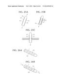 SELF-ANCHORING SLING AND INTRODUCER SYSTEM diagram and image