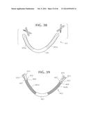 SELF-ANCHORING SLING AND INTRODUCER SYSTEM diagram and image