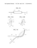 SELF-ANCHORING SLING AND INTRODUCER SYSTEM diagram and image