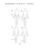 SYSTEM FOR MANAGEMENT AND PREVENTION OF VENOUS POOLING diagram and image