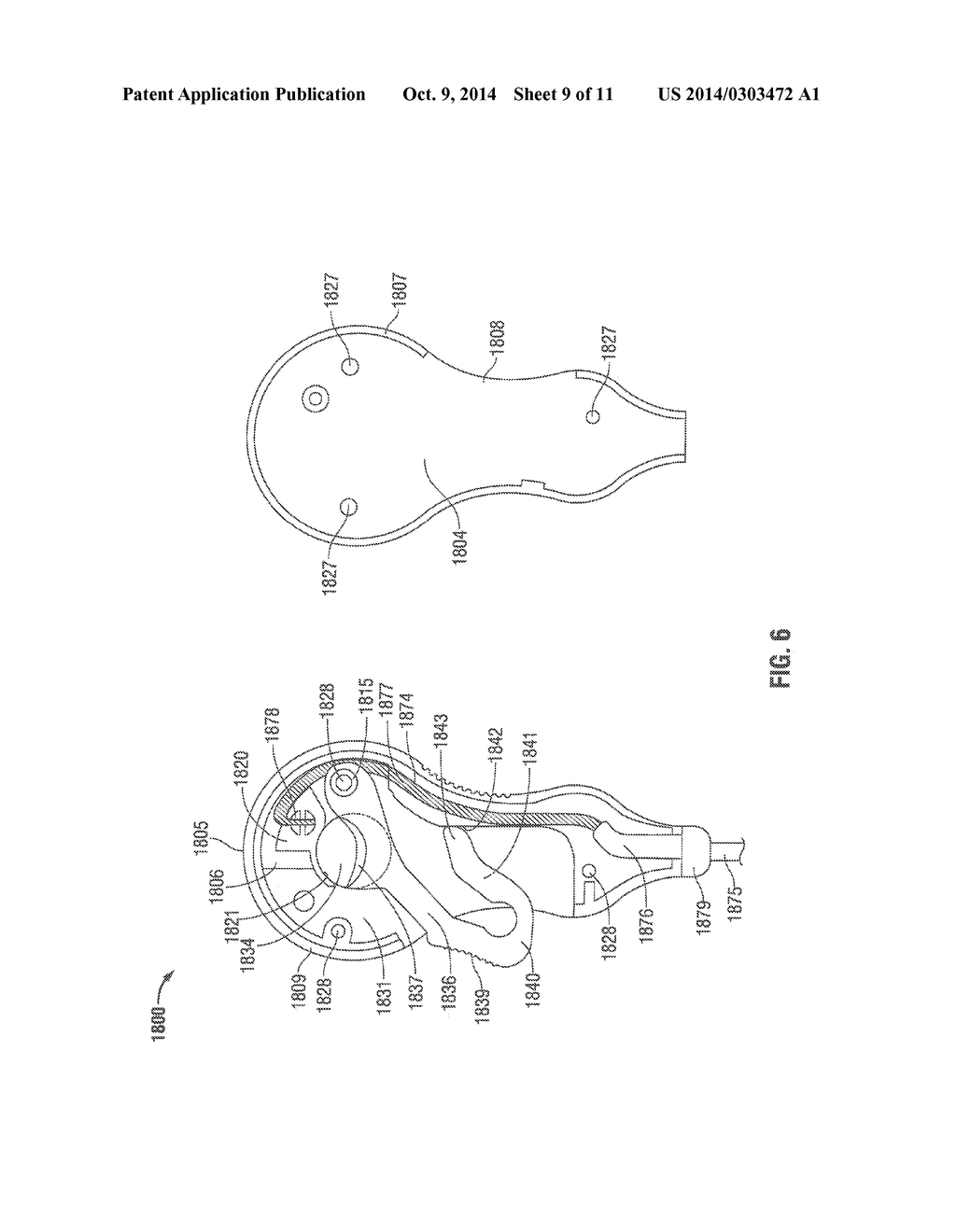 Radiolucent ECG Electrode System - diagram, schematic, and image 10