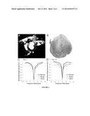 MAGNETIC RESONANCE IMAGING FOR DETECTING CARDIAC DISEASES diagram and image