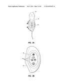 System for Placement of a Catheter Including a Signal-Generating Stylet diagram and image