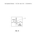 System for Placement of a Catheter Including a Signal-Generating Stylet diagram and image