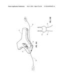 System for Placement of a Catheter Including a Signal-Generating Stylet diagram and image