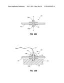 System for Placement of a Catheter Including a Signal-Generating Stylet diagram and image