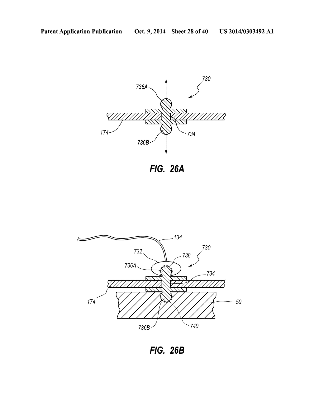 System for Placement of a Catheter Including a Signal-Generating Stylet - diagram, schematic, and image 29