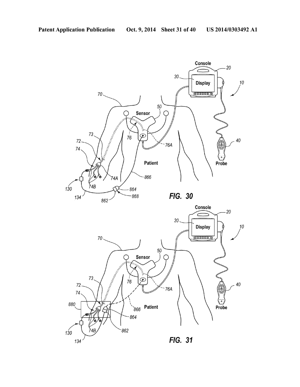 System for Placement of a Catheter Including a Signal-Generating Stylet - diagram, schematic, and image 32