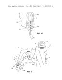 System for Placement of a Catheter Including a Signal-Generating Stylet diagram and image