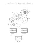 System for Placement of a Catheter Including a Signal-Generating Stylet diagram and image