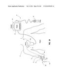 System for Placement of a Catheter Including a Signal-Generating Stylet diagram and image