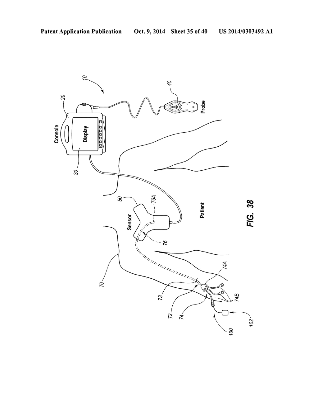 System for Placement of a Catheter Including a Signal-Generating Stylet - diagram, schematic, and image 36