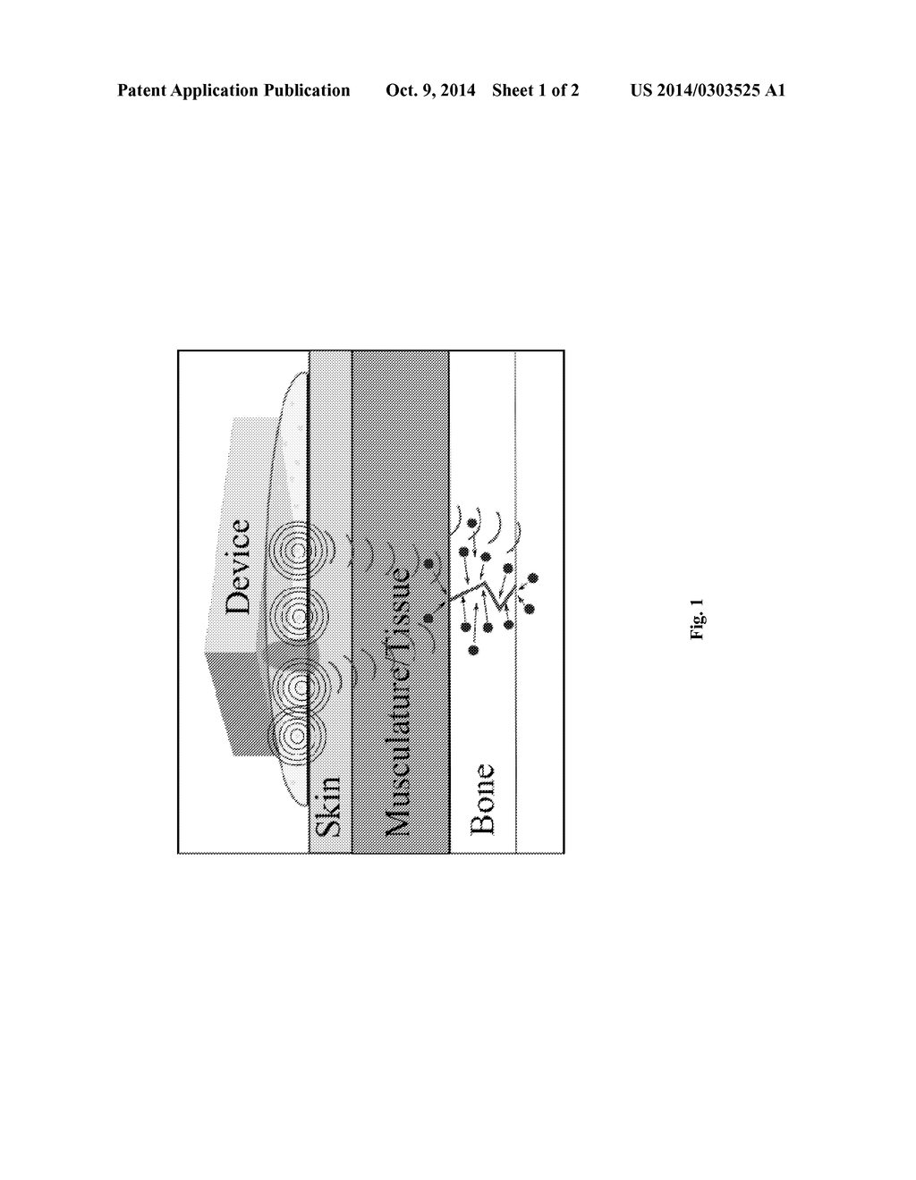 METHOD AND DEVICE FOR NON-INVASIVE ACOUSTIC STIMULATION OF STEM CELLS AND     PROGENITOR CELLS IN A PATIENT - diagram, schematic, and image 02