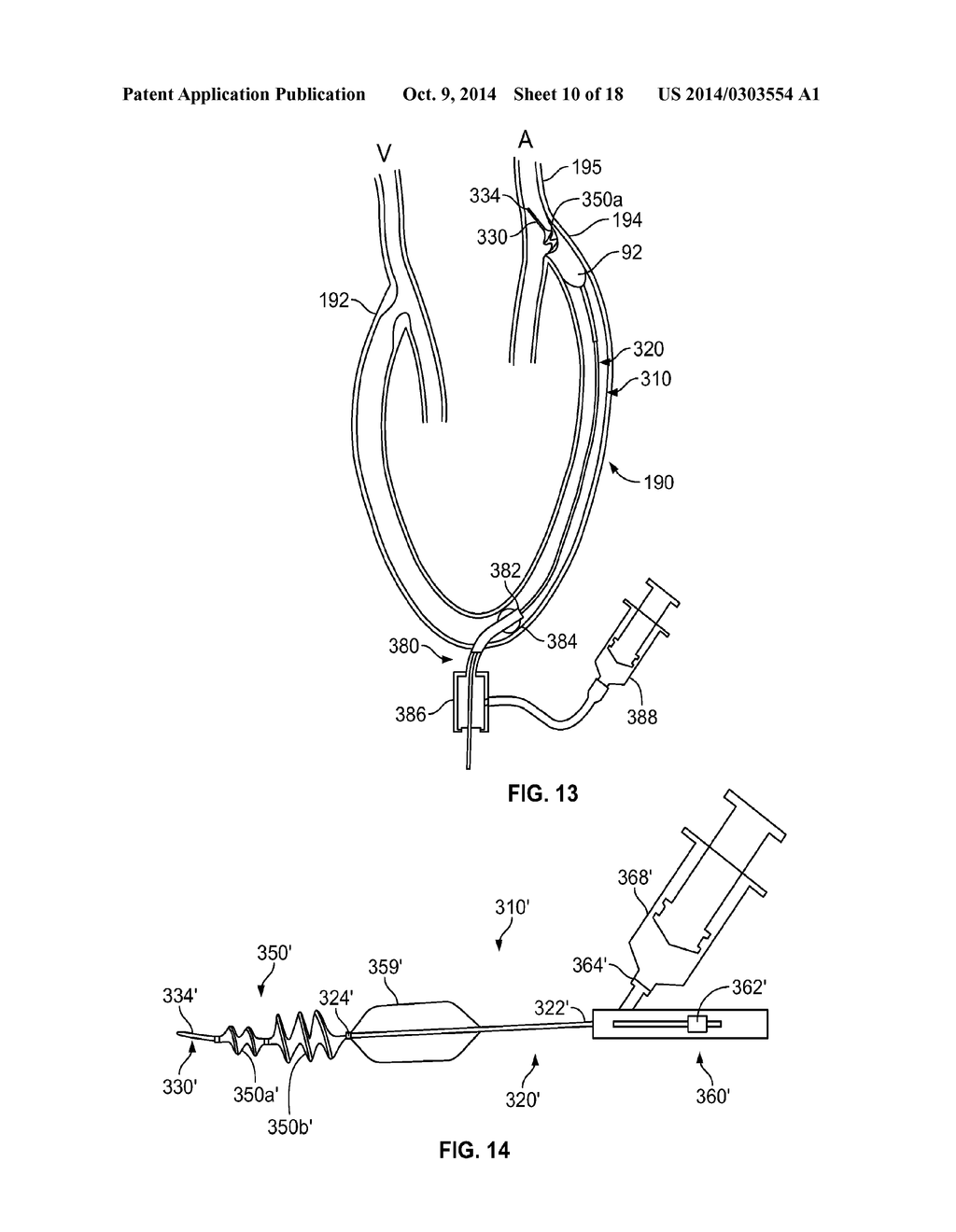 APPARATUS AND METHODS FOR TREATING OBSTRUCTIONS WITHIN BODY LUMENS - diagram, schematic, and image 11