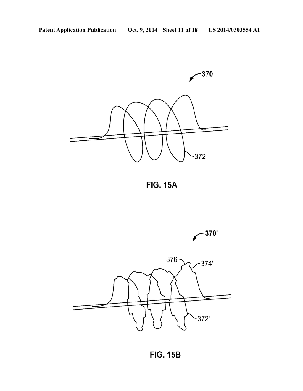 APPARATUS AND METHODS FOR TREATING OBSTRUCTIONS WITHIN BODY LUMENS - diagram, schematic, and image 12