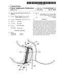 IMPLANTABLE PROSTHESIS FOR FISTULA REPAIR diagram and image