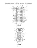 IMPLANTABLE PROSTHESIS FOR FISTULA REPAIR diagram and image