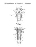 IMPLANTABLE PROSTHESIS FOR FISTULA REPAIR diagram and image