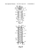 IMPLANTABLE PROSTHESIS FOR FISTULA REPAIR diagram and image