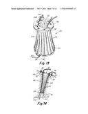 IMPLANTABLE PROSTHESIS FOR FISTULA REPAIR diagram and image