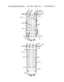 IMPLANTABLE PROSTHESIS FOR FISTULA REPAIR diagram and image