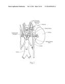 MULTI-DIRECTIONAL DEFLECTABLE CATHETER APPARATUSES, SYSTEMS, AND METHODS     FOR RENAL NEUROMODULATION diagram and image