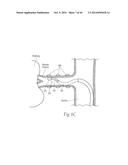 MULTI-DIRECTIONAL DEFLECTABLE CATHETER APPARATUSES, SYSTEMS, AND METHODS     FOR RENAL NEUROMODULATION diagram and image