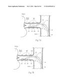 MULTI-DIRECTIONAL DEFLECTABLE CATHETER APPARATUSES, SYSTEMS, AND METHODS     FOR RENAL NEUROMODULATION diagram and image