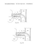 MULTI-DIRECTIONAL DEFLECTABLE CATHETER APPARATUSES, SYSTEMS, AND METHODS     FOR RENAL NEUROMODULATION diagram and image