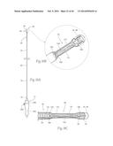 MULTI-DIRECTIONAL DEFLECTABLE CATHETER APPARATUSES, SYSTEMS, AND METHODS     FOR RENAL NEUROMODULATION diagram and image